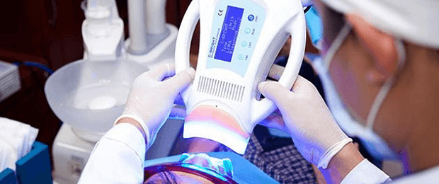 công nghệ tẩy trắng răng plasma radi plus 