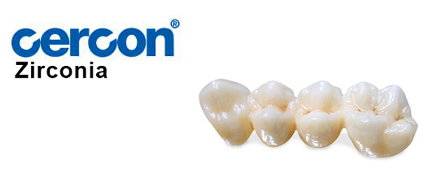 răng toàn sứ cercon zirconia