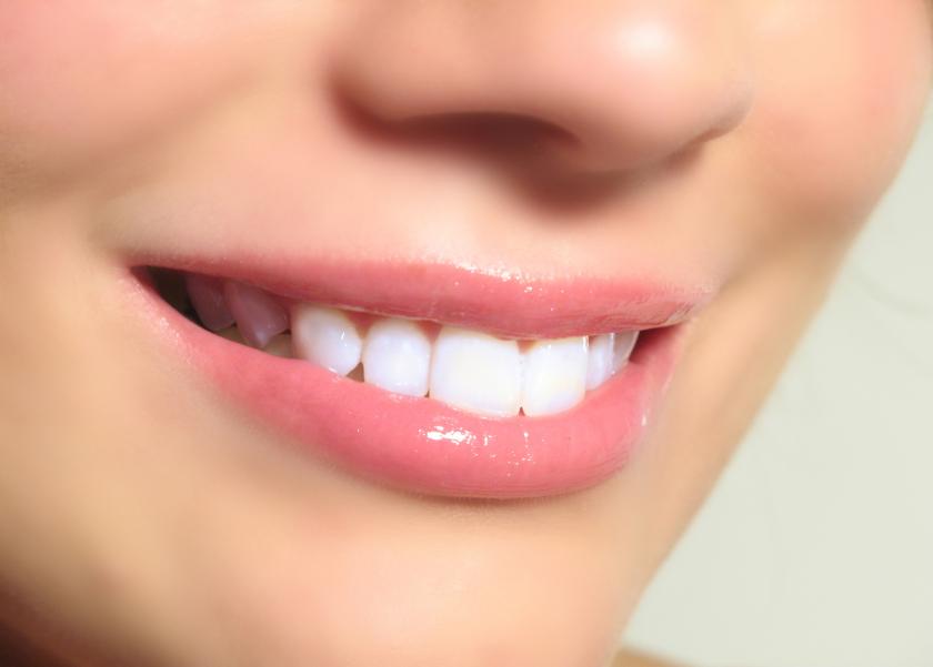 Những chỉ định và lợi ích của việc bọc răng sứ