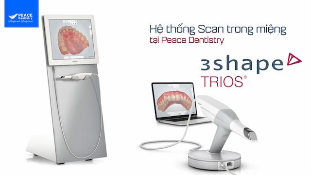 hệ thống scan trong miệng trios 4