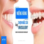 chọn niềng răng mắc cài hay niềng răng invisalign