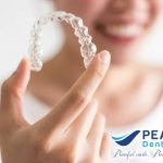 Giá Niềng Răng Invisalign tại nha Khoa Peace, niềng răng trong suốt invisalign, niềng răng invisalign là gì?, niềng răng trong suốt, niềng răng không mắc cài, niềng răng invisalign giá, chi phí niềng răng invisalign, niềng răng invisalign giá rẻ,niềng răng invisalign có đau không ?, chỉnh nha invisalign, niềng răng invisalign trả góp, phương pháp niềng răng invisalign, khay niềng invisalign, niềng răng invisalign có hiệu quả không