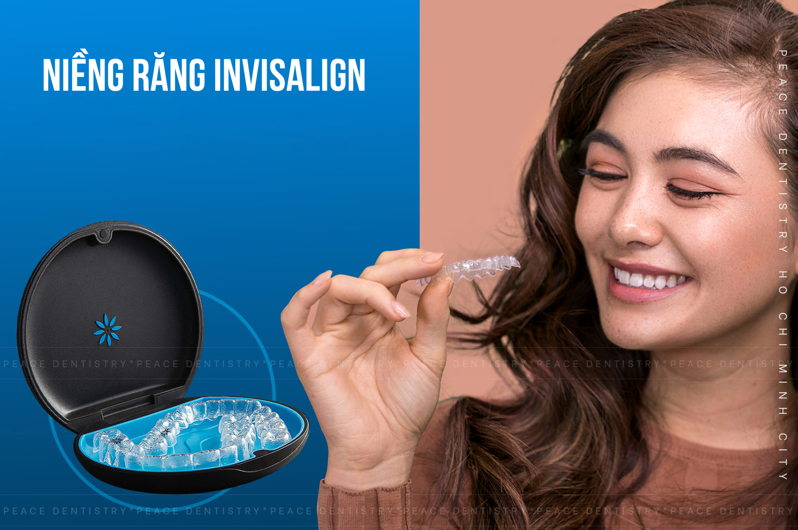 Invisalign có tác dụng như thế nào trong việc chỉnh hình răng?