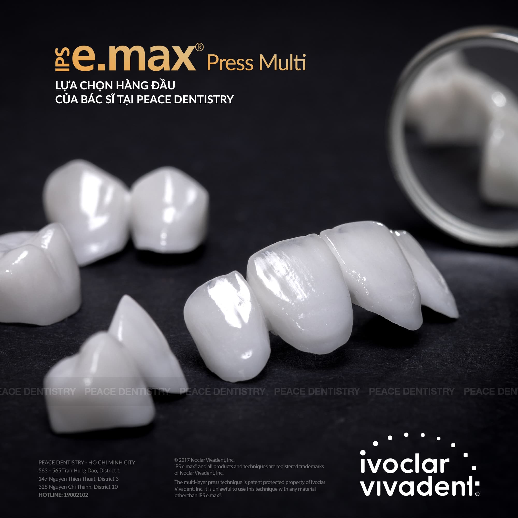 IPS Emax Press Multi siêu phẩm Veneer từ Ivoclar VivaDent