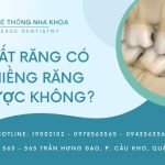 mất răng có niềng răng được không