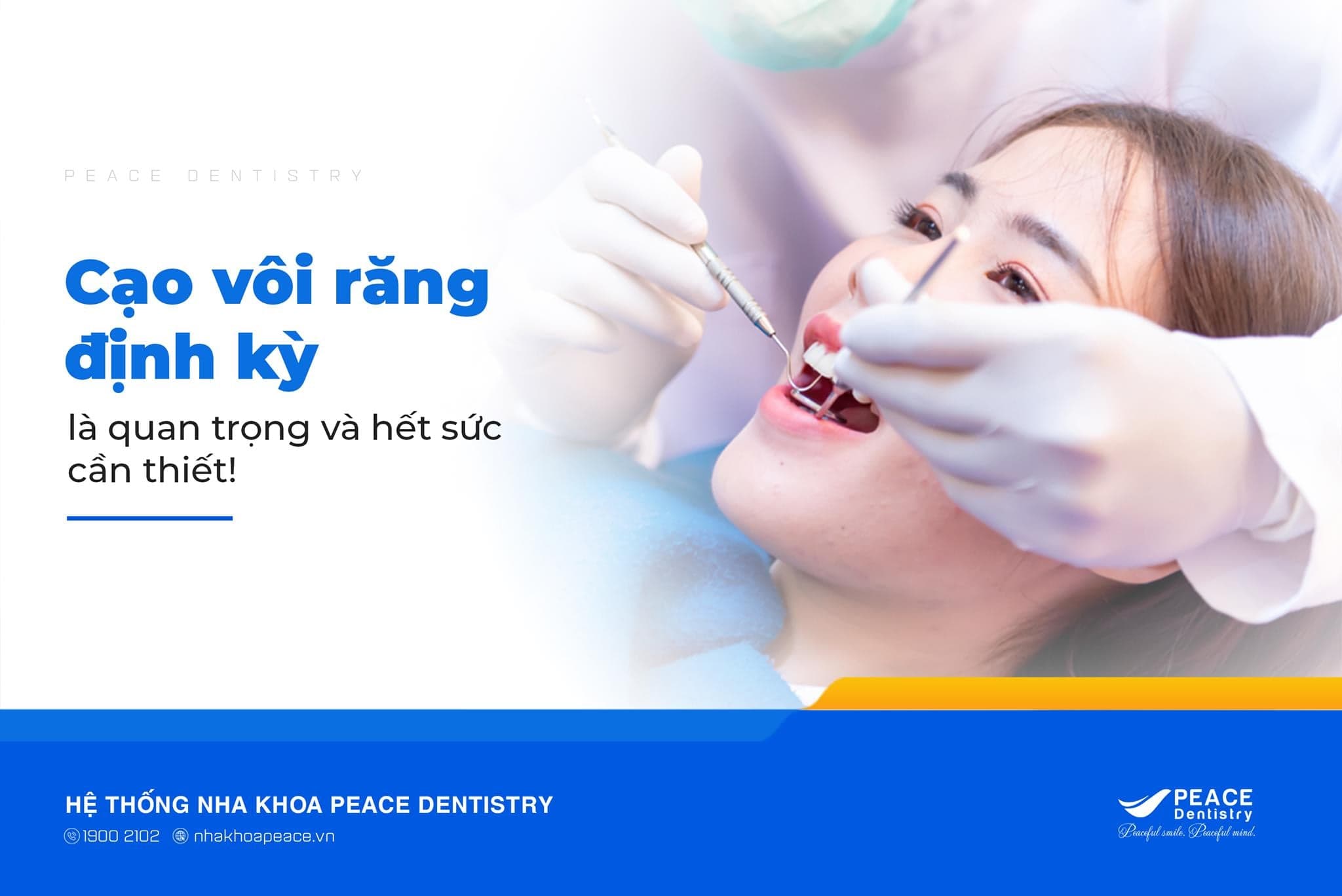 cạo vôi răng định kỳ