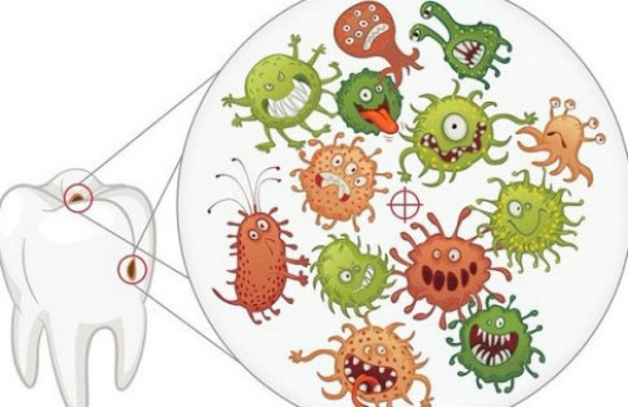 vi khuẩn Streptococus mutans gây sâu răng