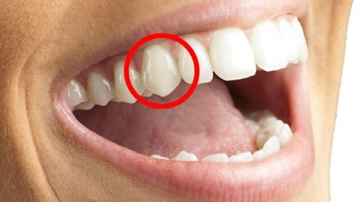 răng số 3 có nhiều chức năng