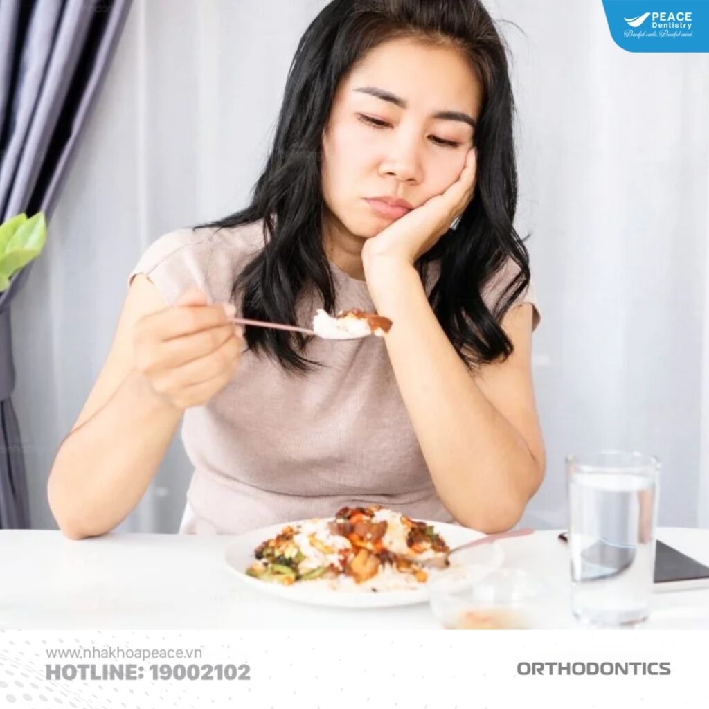 nguyên nhân nhiệt miệng khi niềng răng