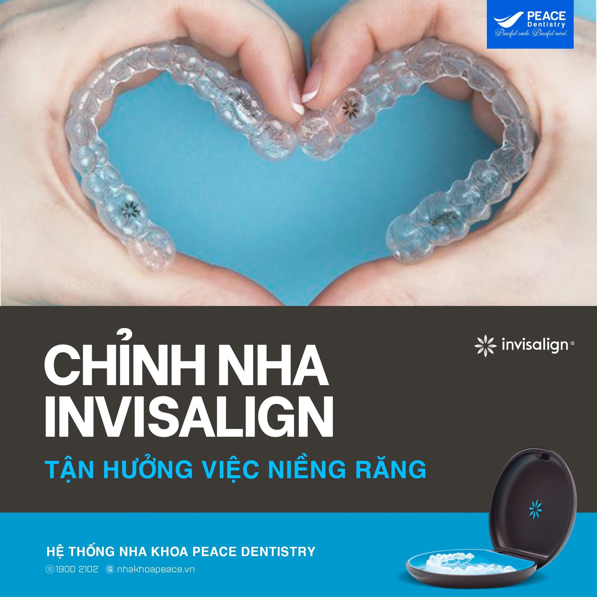 niềng răng trong suốt là gì