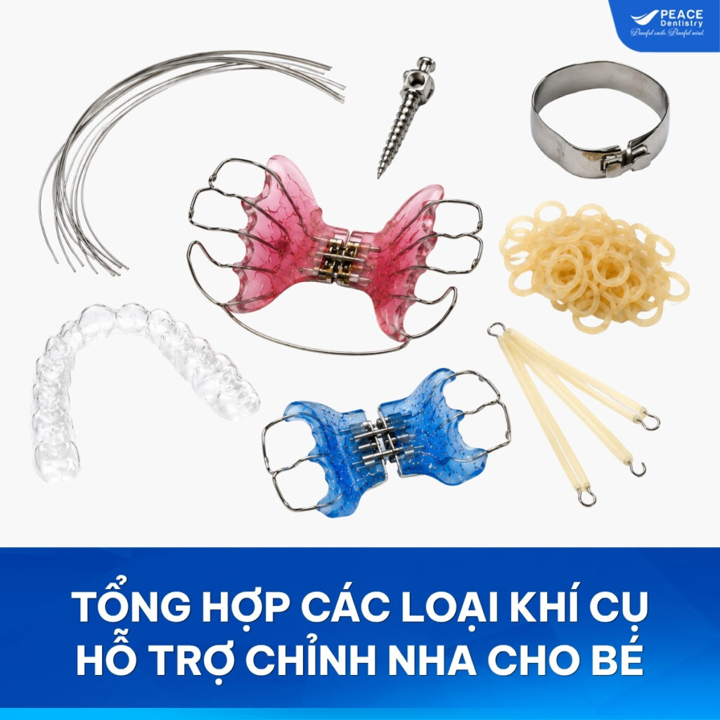 khí cụ chỉnh nha cho bé