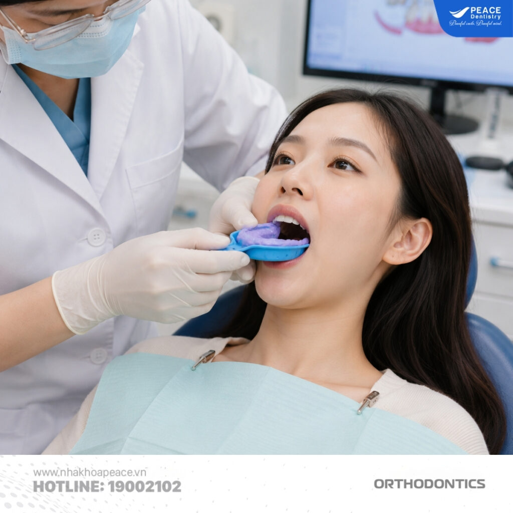 lấy mẫu răng để niềng