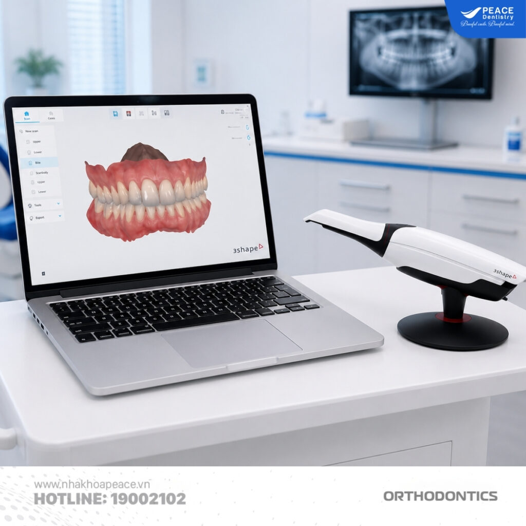 lấy dấu răng bằng kỹ thuật số 3d