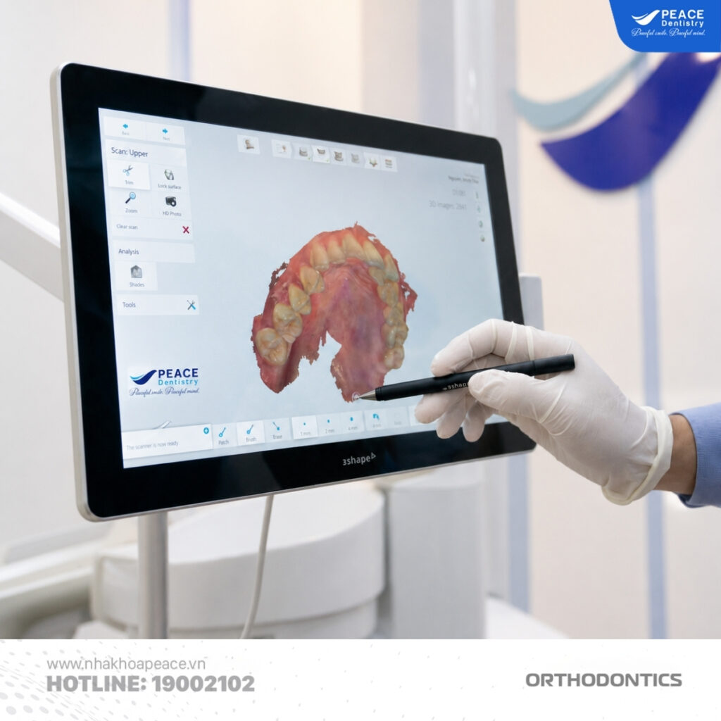máy scan trong miệng trios 4 3shape