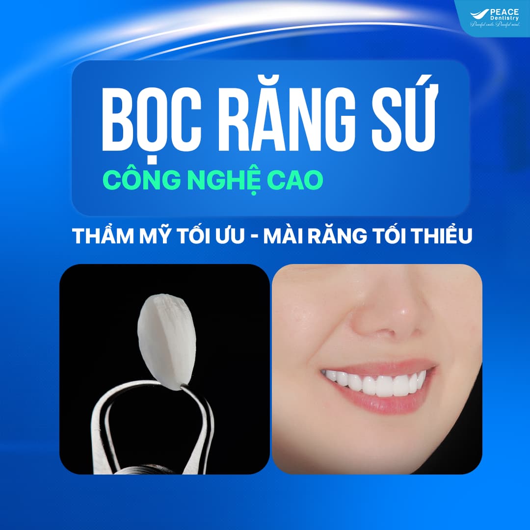 banner trang chủ