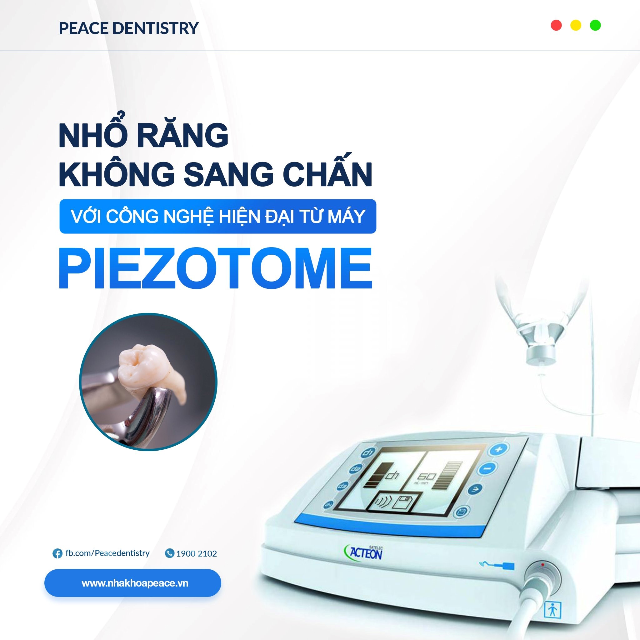 nhổ răng khôn bằng máy piezotome