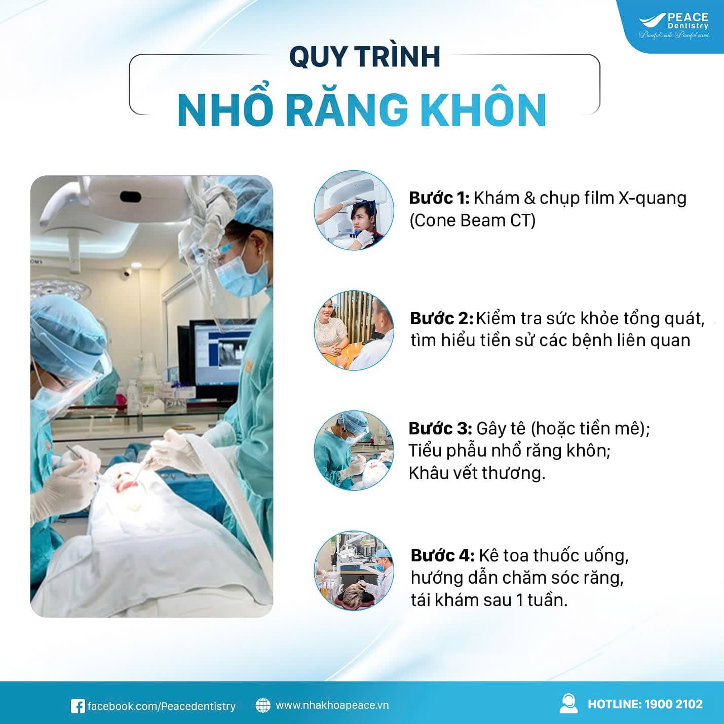 quy trình nhổ răng khôn tại peace dentistry quận 3