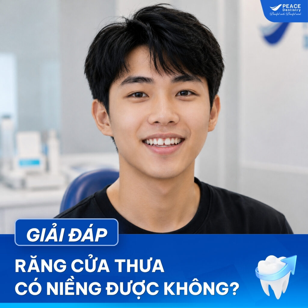 răng cửa bị thưa có niềng được không