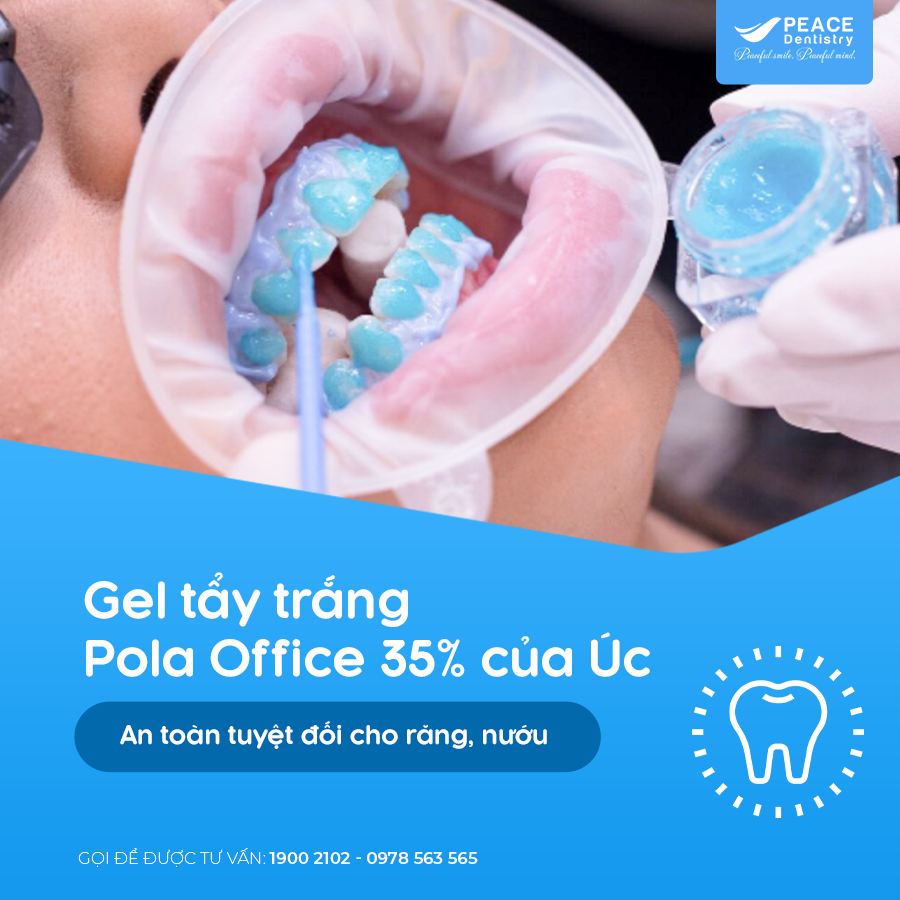 thuốc tẩy pola office 35%