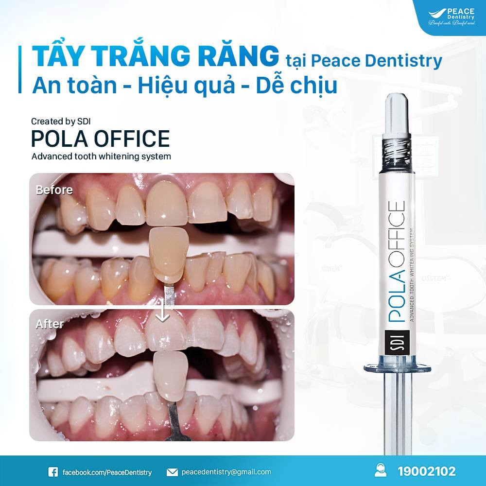 thuốc tẩy trắng chính hãng