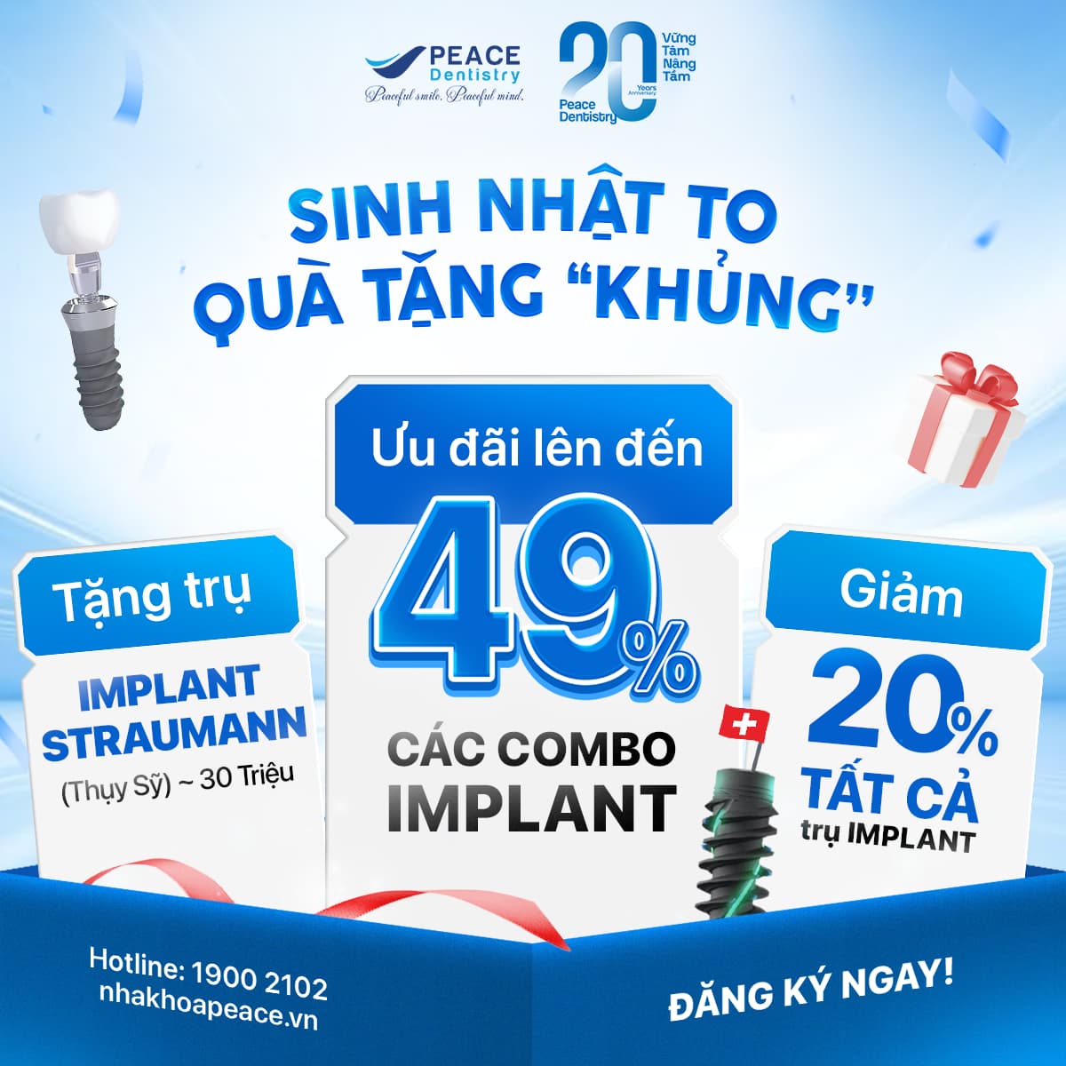 banner implant 20 năm