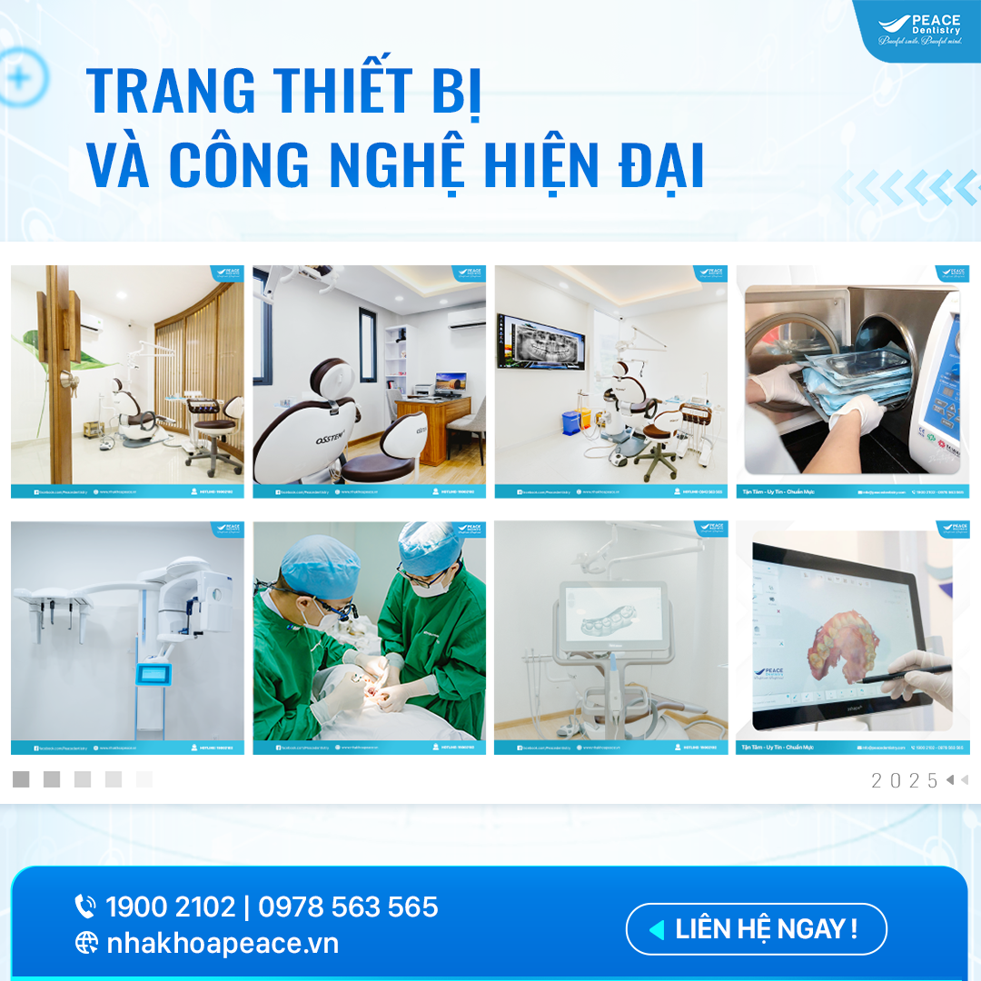 trang thiết bị công nghệ cấy ghép implant hiện đại tại peace dentistry