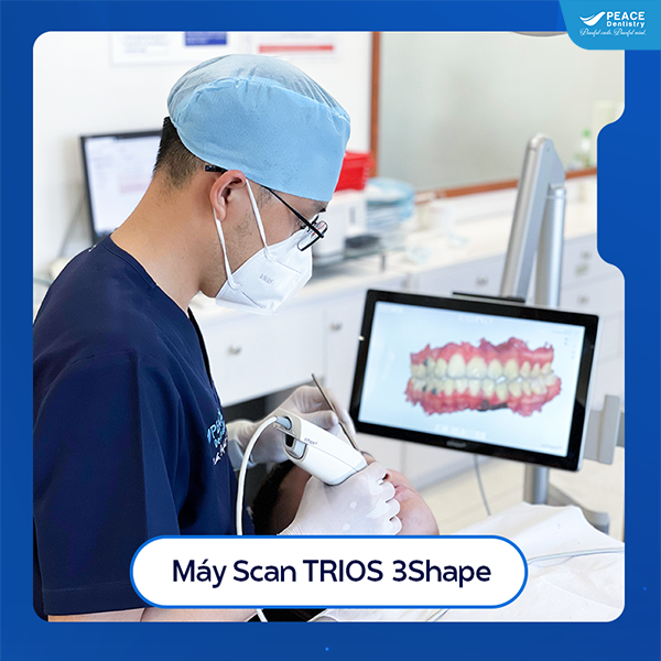 máy scan trong miệng trios 3shapre đan mạch