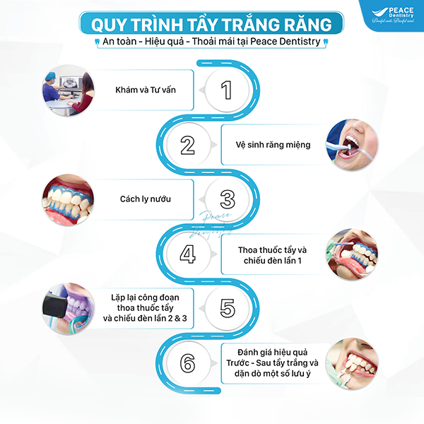 quy trình tẩy trắng răng hiệu quả