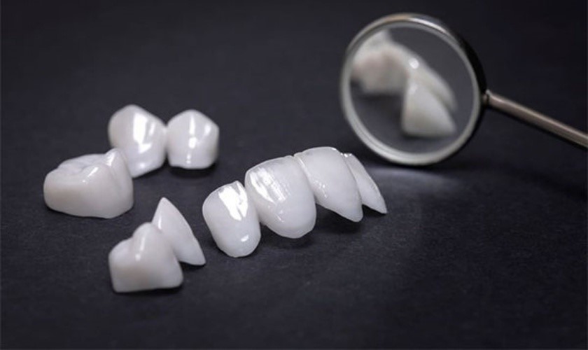 cách giữa răng sứ bền màu