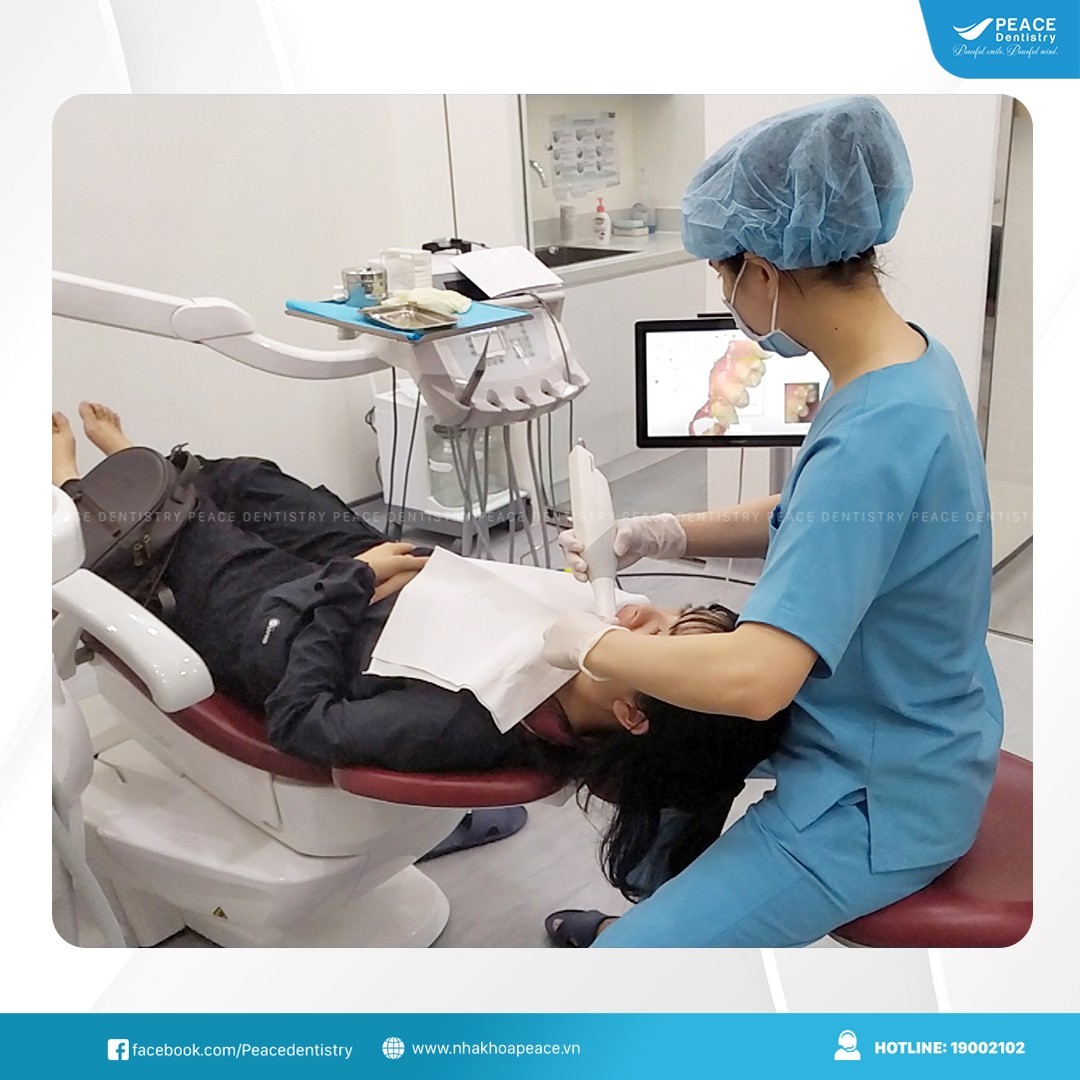 công nghệ scan 3d niềng răng trong suốt