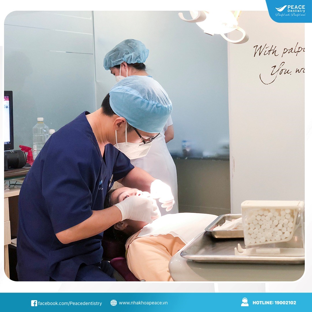 lưu ý khi bọc răng sứ