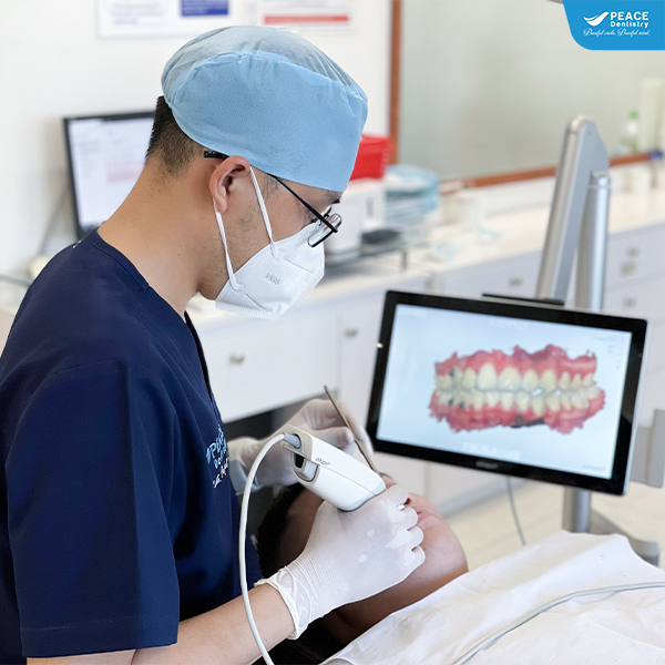 máy scan 3d niềng răng tại peace dentistry