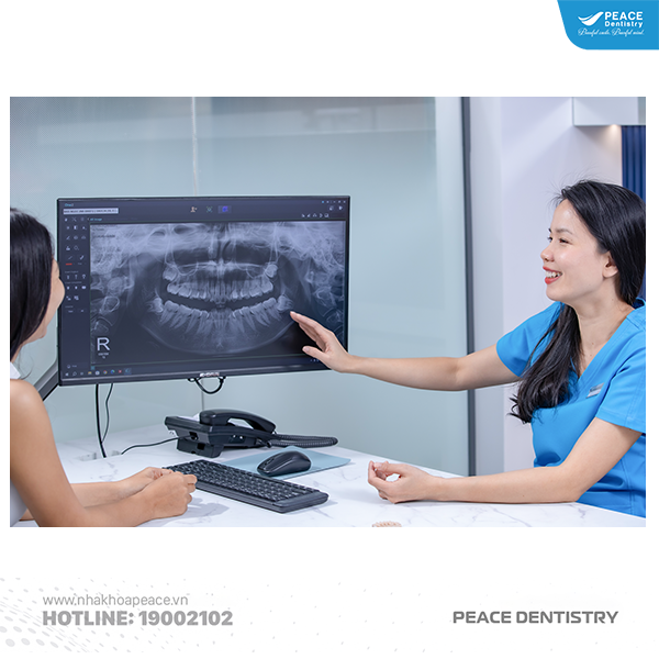chỉnh nha có cần phải nhổ răng hay không