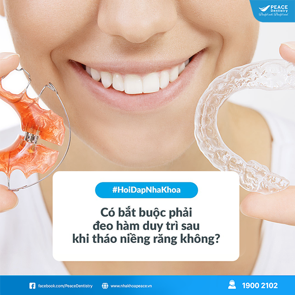 niềng răng đeo hàm duy trì trong bao lâu