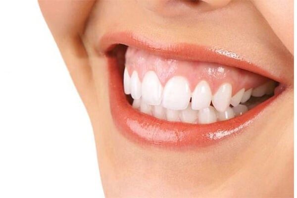 phụ nữ cười hở lợi ảnh hưởng gì