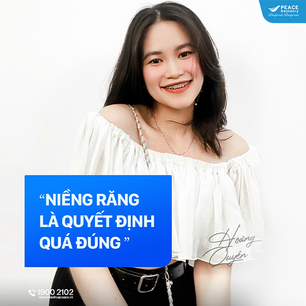thẩm mỹ tối ưu khi niềng răng