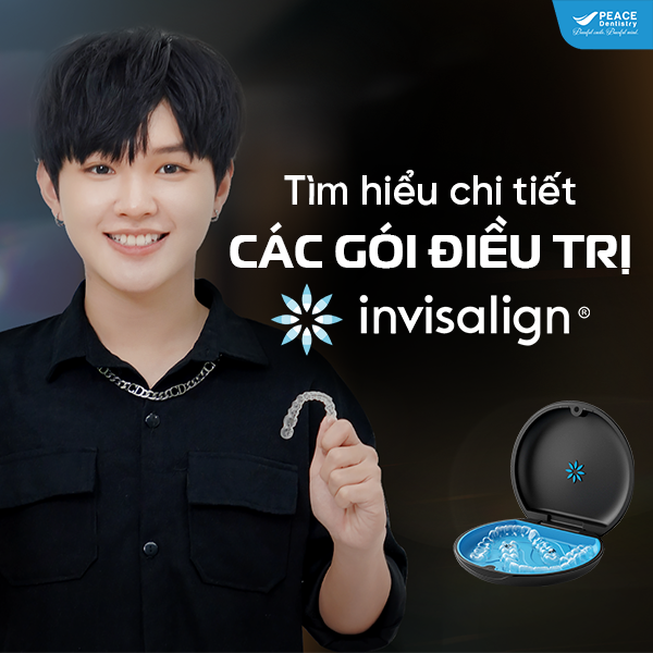 các gói niềng răng invisalign