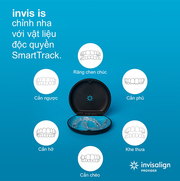 niềng răng invisalign giá cao tùy vào tình trạng răng miệng