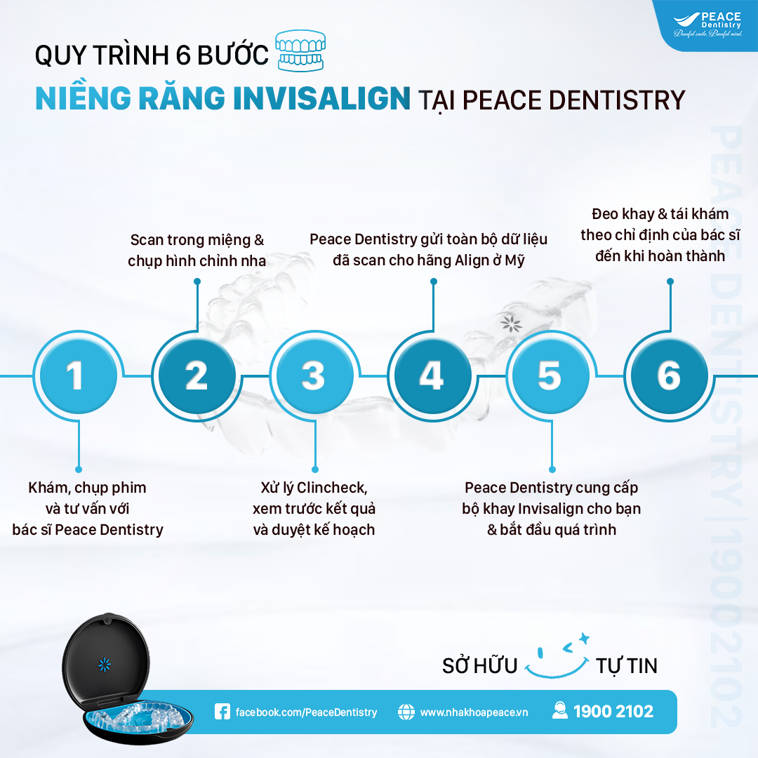 quy trình niềng răng invisalign