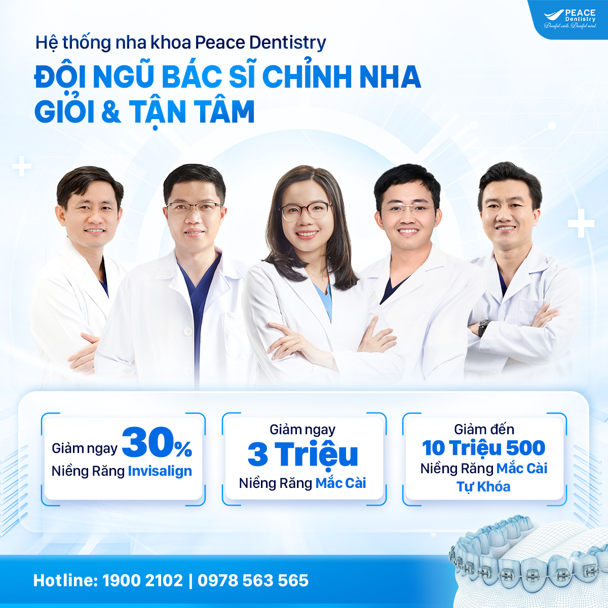 banner niềng răng