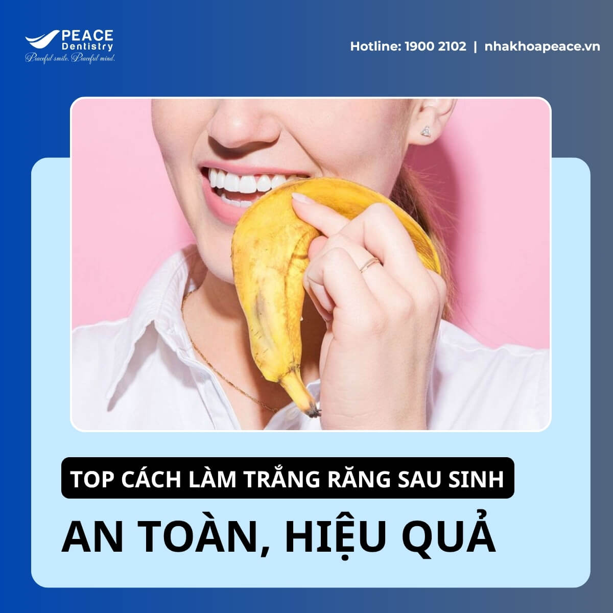 cách làm trắng răng sau sinh