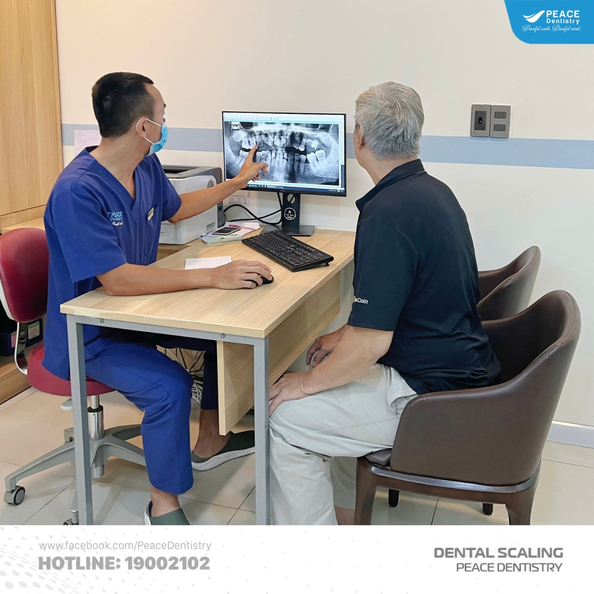 cách xử lý cao răng huyết thanh