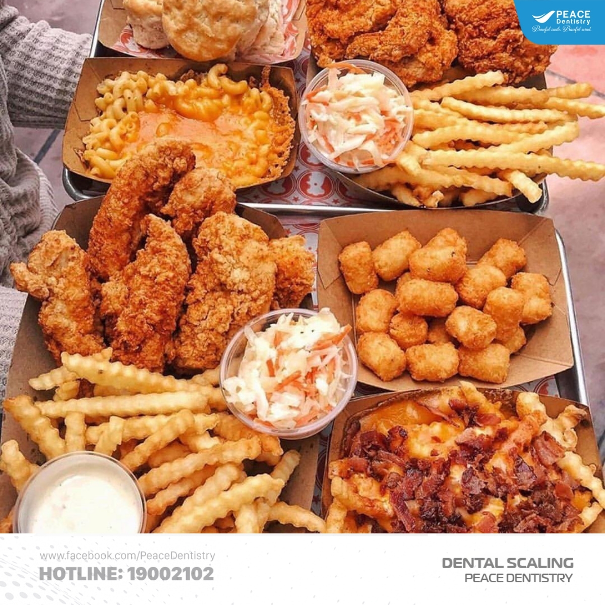 nguyên nhân hình thành cao răng