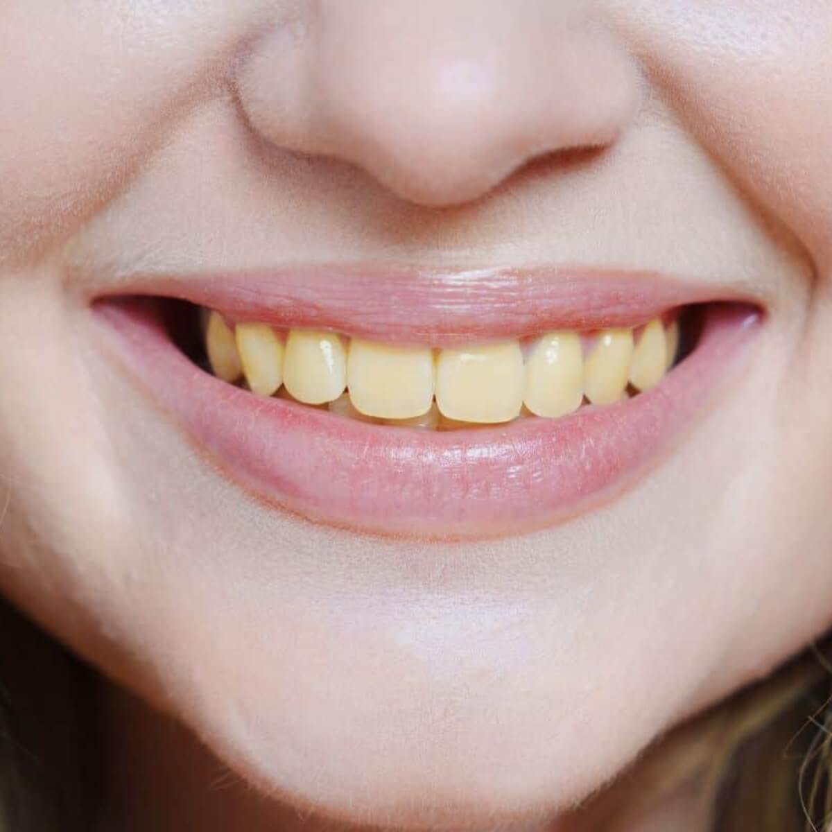 nguyên nhân sau sinh răng bị ố vàng