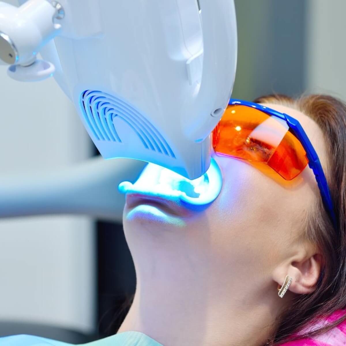 sau sinh bao lâu thì tẩy trắng răng được