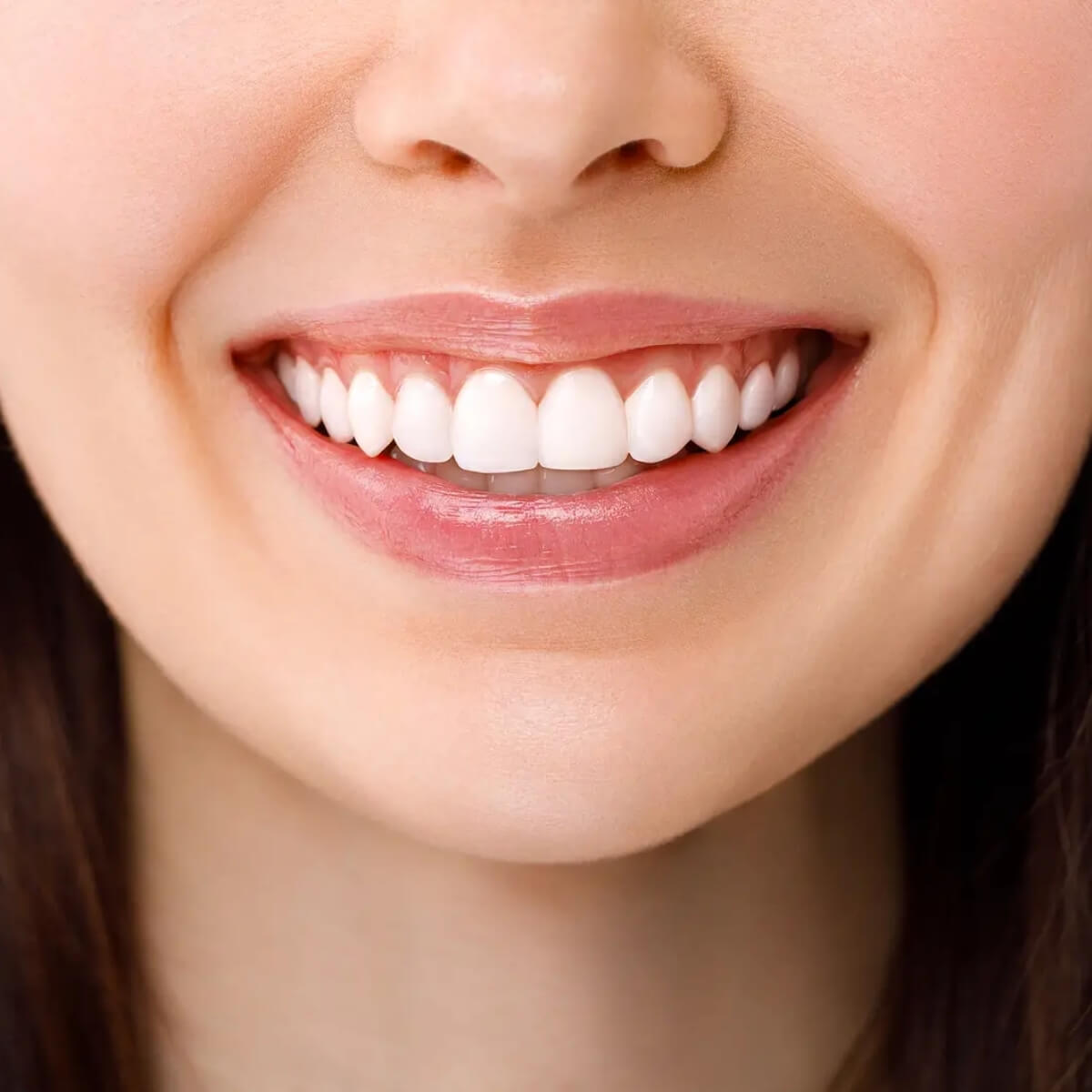 tại sao cần chăm sóc răng sau khi tẩy trắng