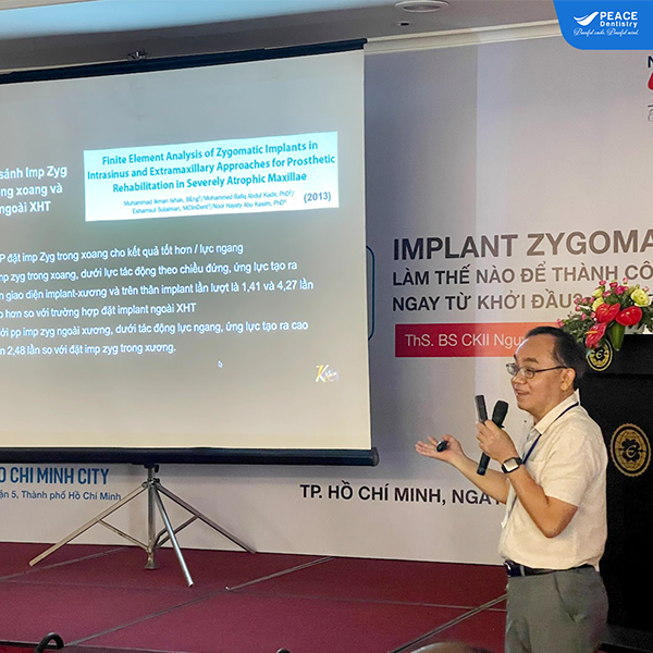 ths bs ckII nguyễn văn khoa báo cáo viên kỹ thuật cấy ghép implant zygoma xương gò má
