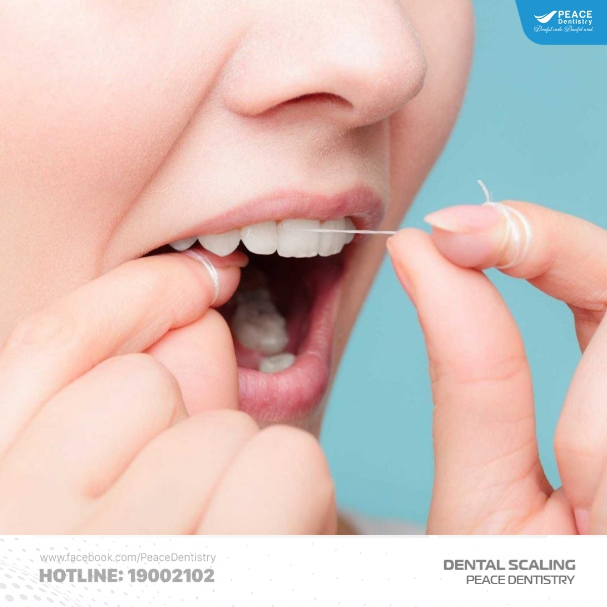 vệ sinh răng miệng đúng cách hạn chế cao răng