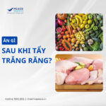 ăn gì sau khi tẩy trắng răng