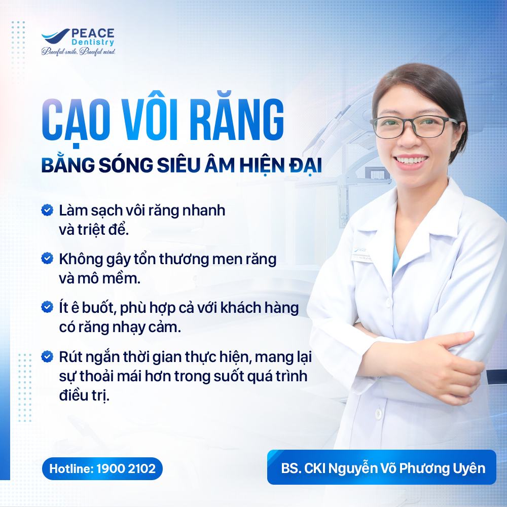 cạo vôi bằng sóng siêu âm